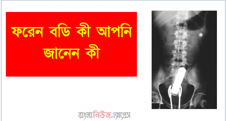 'ফরেন বডি' বা যৌন পন্যের ছড়াছড়ি, ফরেন বডি মানে কি?