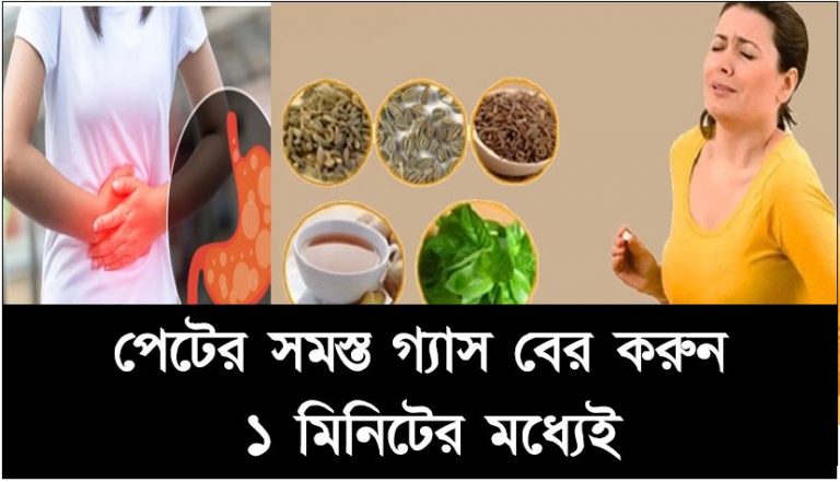 পেটের সমস্ত গ্যাস বের করুন ১ মিনিটের মধ্যেই, মাত্র ১ মিনিটে পেটের সকল গ্যাস দূর করার উপায়,ঔষধে নয়-৪টি ঘরোয়া উপাদানেই, পেট থাকবে একদম ক্লিয়ার