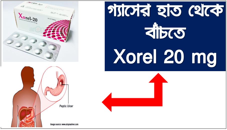 Xorel 20 mg ট্যাবলেট ভালো নাকি ক্যাপসুল, জোরেল/Xorel জেনে নিন গোপন রহস্য,Xorel 20 Mg Tablet Bangla Review, গ্যাস্ট্রিক দূর করার উপায় ঔষধ জোরেল
