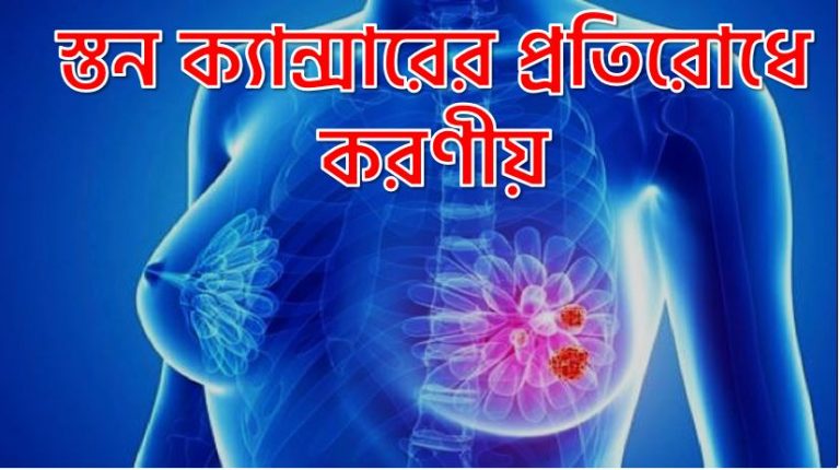 স্তন ক্যান্সারের প্রতিরোধে করণীয়,স্তন ক্যান্সারের প্রতিরোধের উপায় ,স্তন ক্যান্সারের প্রতিকার,স্তন ক্যান্সারের প্রতিরোধ করা যায় কি, স্তন ক্যান্সারের আধুনিক চিকিৎসা, স্তন ক্যান্সারের প্রতিরোধ সম্ভব