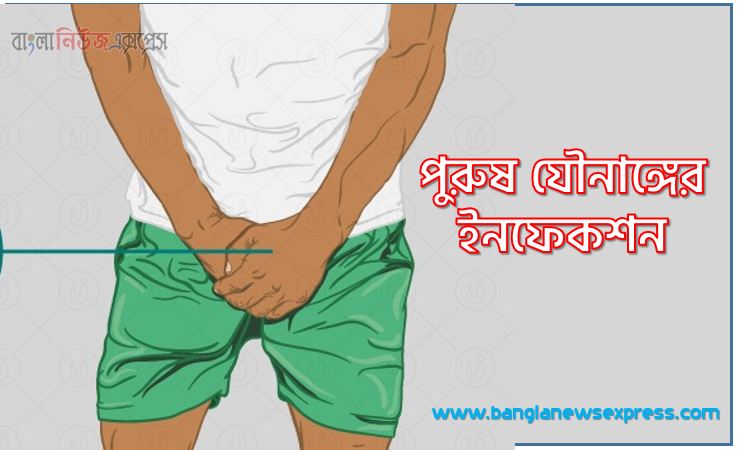 পুরুষ যৌনাঙ্গের ইনফেকশন, যৌনাঙ্গের পাশে চুলকানি,যৌনাঙ্গে চুলকানি,পুরুষ ও নারীর যৌনাঙ্গ চুলকানি সমস্যার সমাধান,যৌনাঙ্গে চুলকানি দূর করার ক্রিম,যৌনাঙ্গে চুলকানি কেনো হয়?