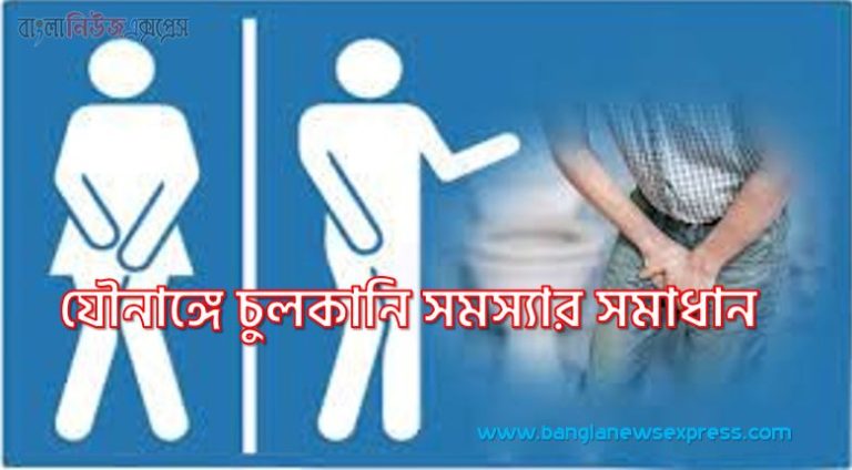 যৌনাঙ্গ চুলকানি,যৌনাঙ্গে চুলকানি সমস্যার সমাধান,যৌনাঙ্গে চুলকানি হলে করণীয় কি?,যৌনাঙ্গে চুলকানি কি করবো,যৌনাঙ্গে ইচিং বা চুলকানি,জরায়ু মুখের ইনফেকশন,প্রস্রাবে ইনফেকশন